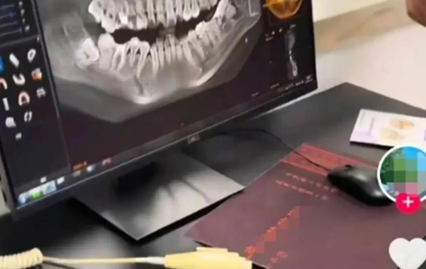 “女子拔牙5日后坠亡”后续：涉事医生被通报批评、暂停门诊3个月 最终调查定论待后续公布 -华闻时空