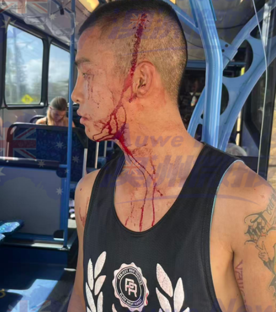 澳华人职业拳手和妻子公交车遇袭! 遭多名土著辱骂暴力攻击! 头破血流失去意识, 紧急送医-华闻时空